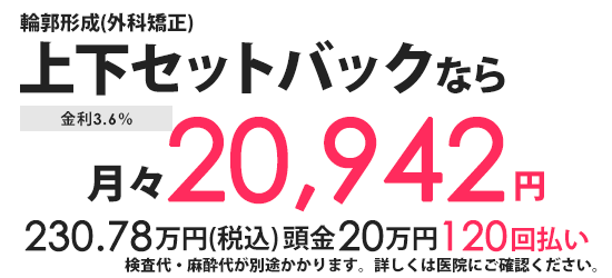 分割払い 月々の金額