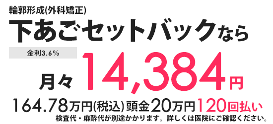 分割払い 月々の金額