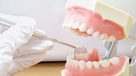 予防歯科での定期検診