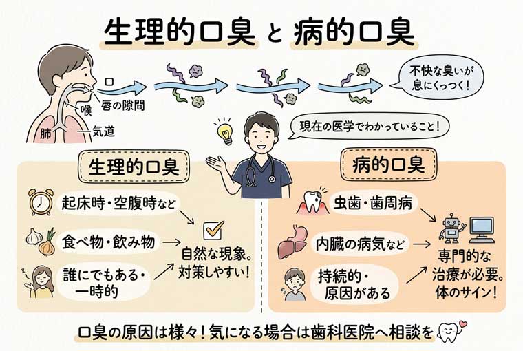 生理的口臭と病的口臭の図解