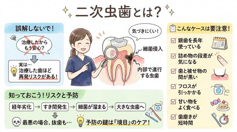 二次虫歯とは？の図解