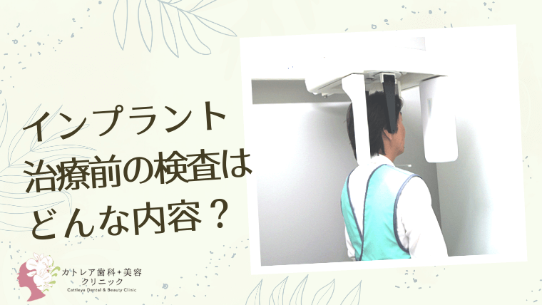 インプラント治療前の検査はどんな内容？