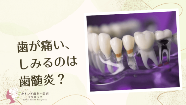 歯が痛い、しみるのは歯髄炎？すぐに治療が必要？