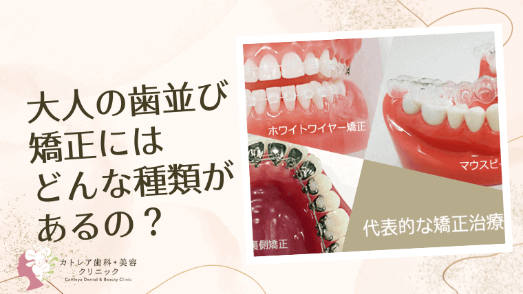 大人の歯並び矯正にはどんな種類があるの？