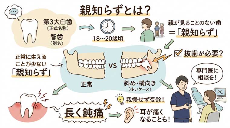 親知らずとは？の図解
