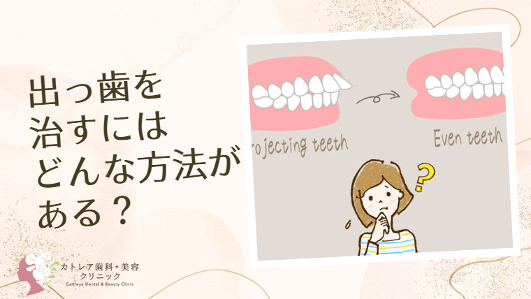 出っ歯を治すにはどんな方法がある？