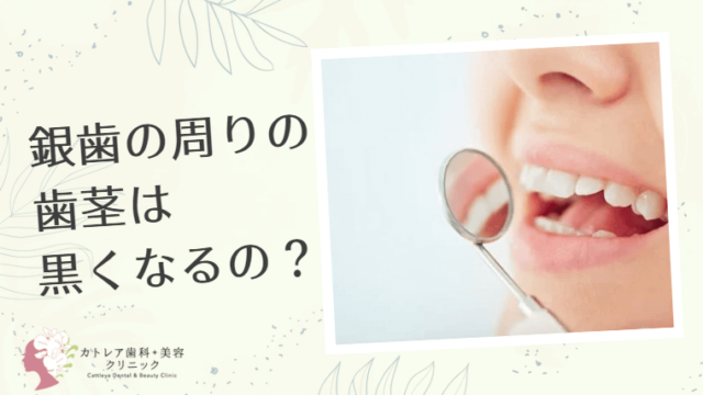 銀歯の周りの歯茎は黒くなるの？