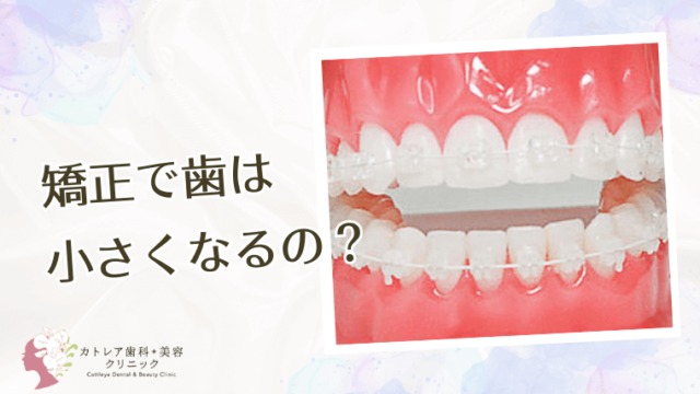 矯正で歯は小さくなるの？