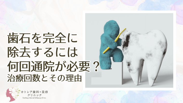 歯石を完全に除去するには何回通院が必要?