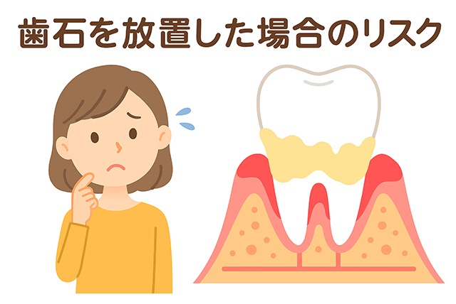 放置した場合のリスク