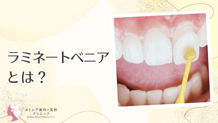 ラミネートべニアとは?