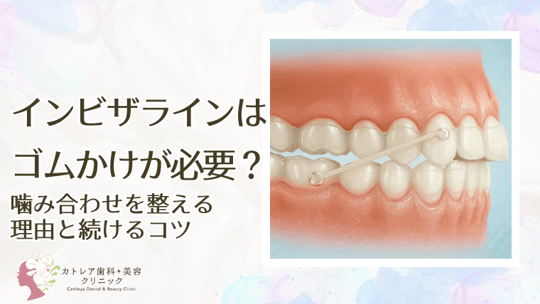 インビザラインはゴムかけが必要?