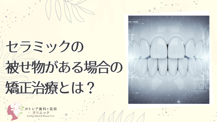 セラミックの被せ物がある場合の矯正治療とは？
