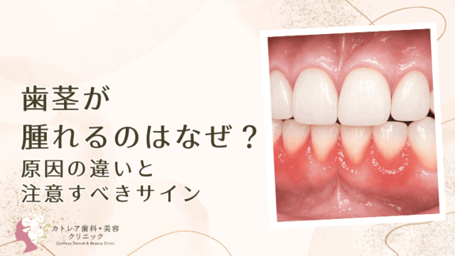 歯茎が腫れるのはなぜ？原因の違いと注意すべきサイン