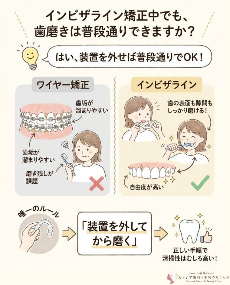 インビザライン矯正中でも、歯磨きは普段通りできますか？