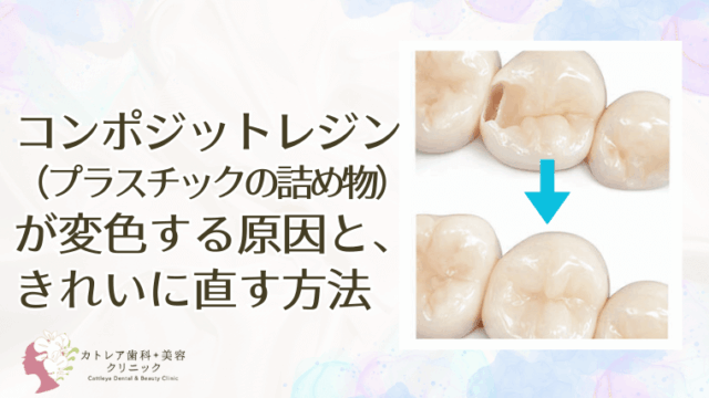コンポジットレジン（プラスチックの詰め物）が変色する原因と、きれいに直す方法