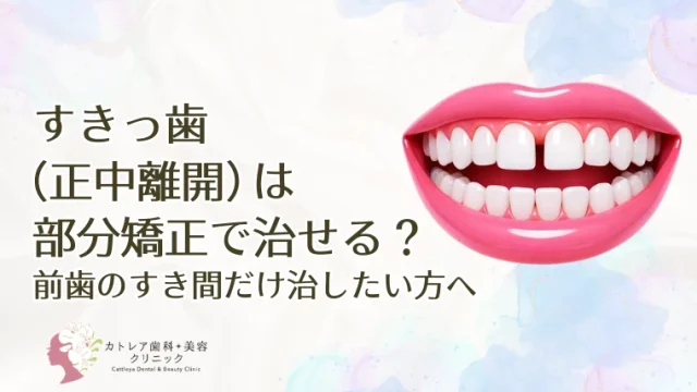 すきっ歯（正中離開）は部分矯正で治せる？前歯のすき間だけ治したい方へ