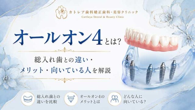 オールオン4とは？総入れ歯との違い・メリット・向いている人を解説