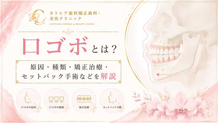 口ゴボとは？原因・種類・矯正治療・セットバック手術などを解説