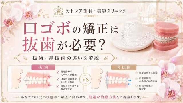 口ゴボの矯正は抜歯が必要？抜歯・非抜歯の違いを解説