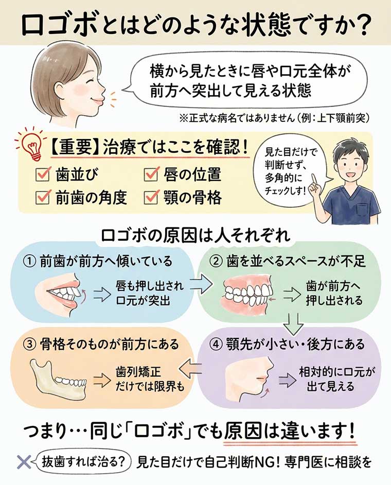 口ゴボとはどのような状態ですか？の図解