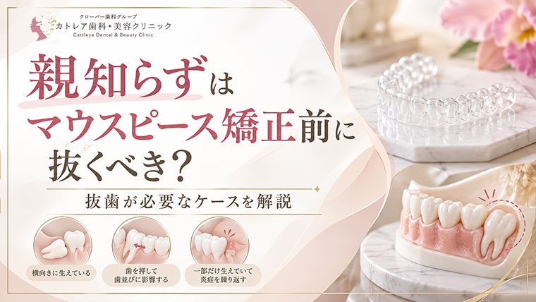 親知らずはマウスピース矯正前に抜くべき？抜歯が必要なケースを解説