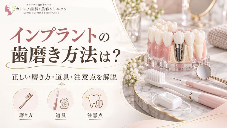 インプラントの歯磨き方法は？正しい磨き方・道具・注意点を解説