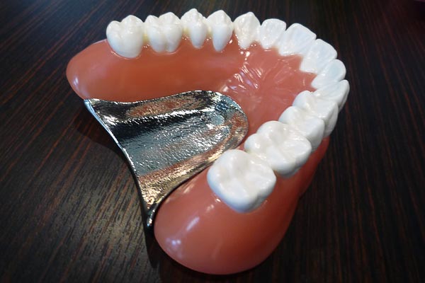入れ歯治療（義歯）