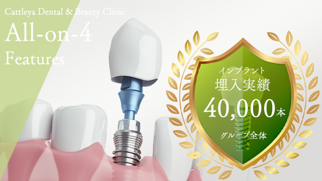 インプラント治療実績