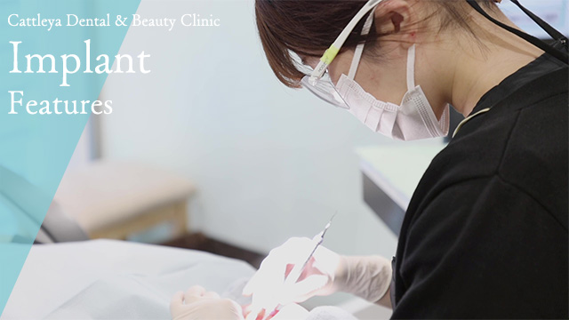 インプラントのメンテナンス