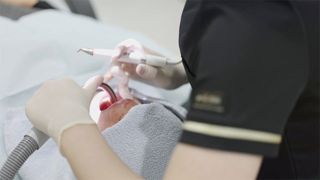 オールオン4のメンテナンス