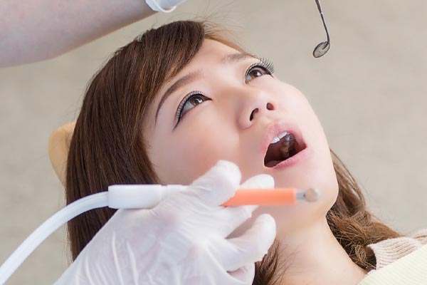 虫歯の検査