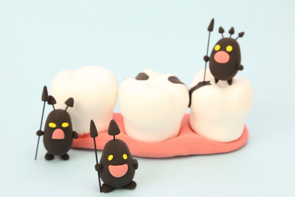 虫歯のイメージ