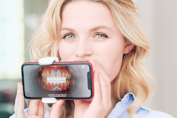 デンタルモニタリング