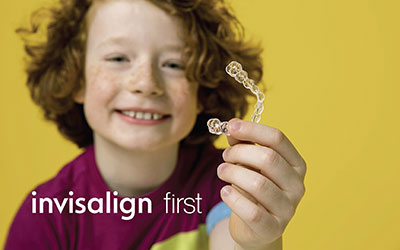 インビザラインファースト