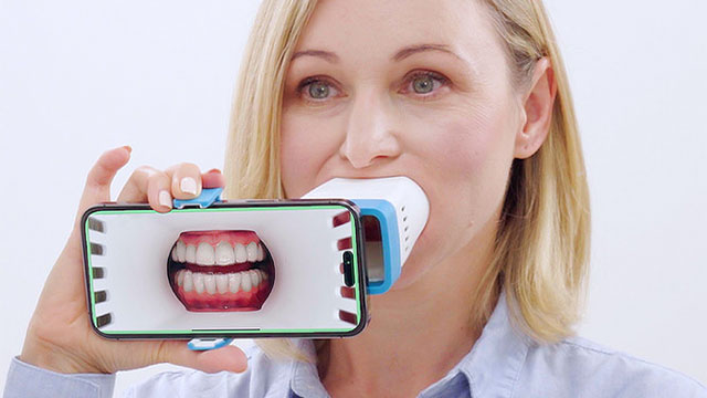 インビザライン バーチャルケア