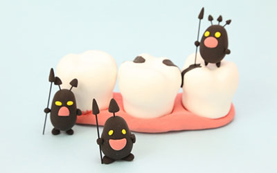 虫歯や歯周病のリスクが少ない