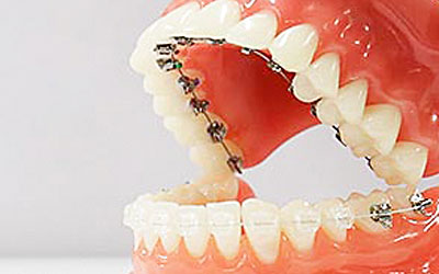 ハーフリンガル