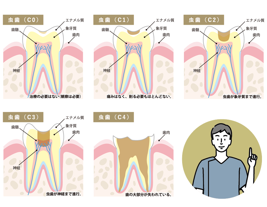 虫歯 肩 の 痛み